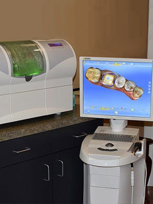 CEREC technology