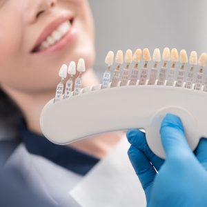 dentist matching shade of patient's smile with model teeth